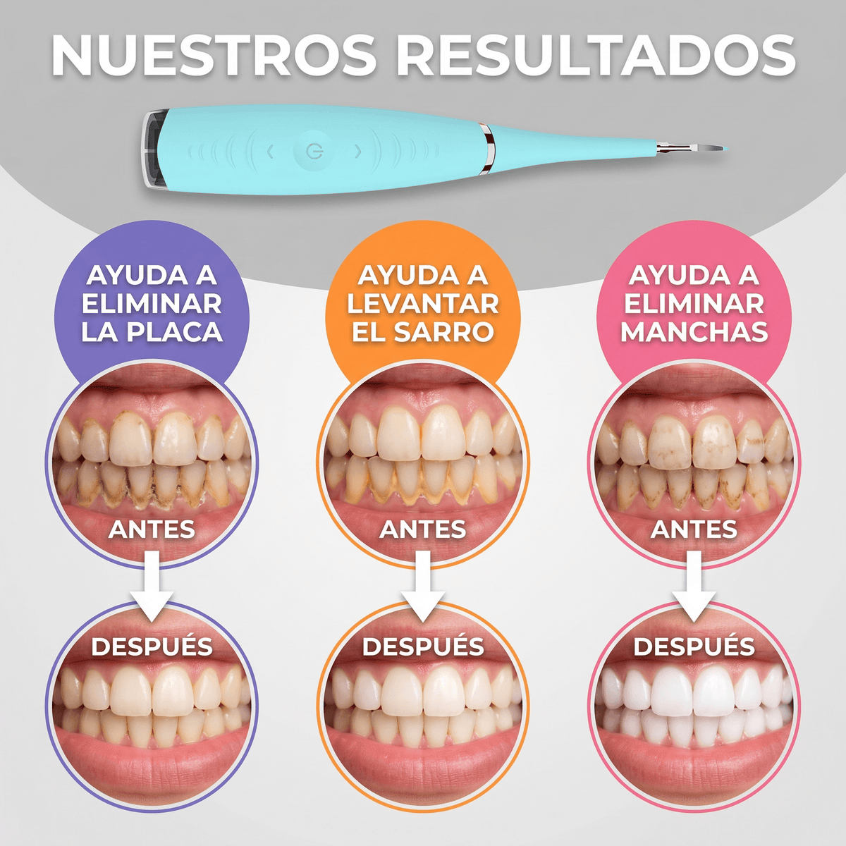 Limpiador Dental Eléctrico Denvia — Antisarro y Blanqueador