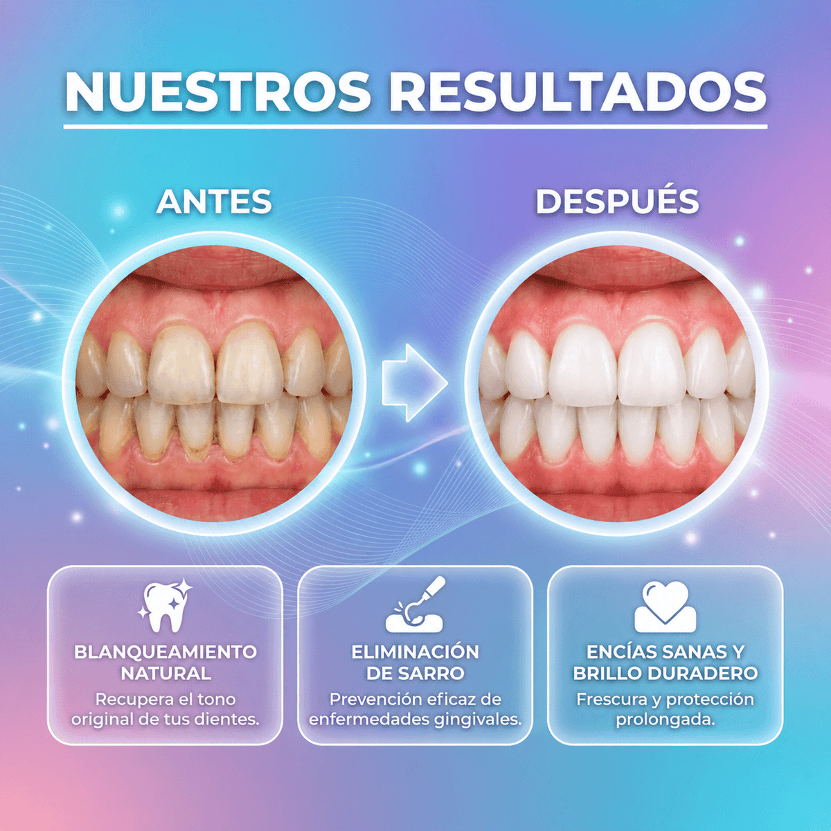Limpiador Dental Eléctrico Denvia — Antisarro y Blanqueador