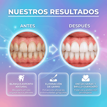 Limpiador Dental Eléctrico Denvia — Antisarro y Blanqueador